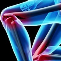 Kloubní náhrady a osteotomie