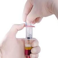 Ortho biologická léčba