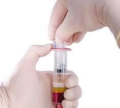 Léčba krevní plazmou? Kdy je vhodná a kdy není?